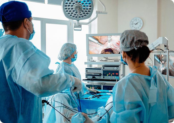 Laparoscopy Surgeries