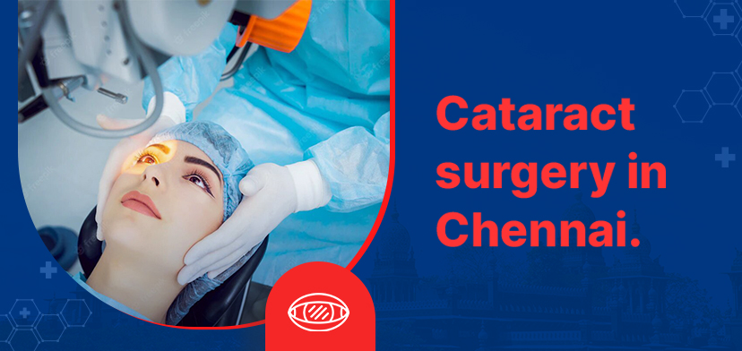 Cataract surgery in Chennai – Cost and treatment | GMoney