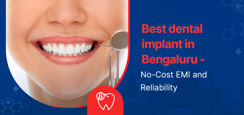 Best Dental Implant In Bengaluru | No-Cost EMI And Reliability
