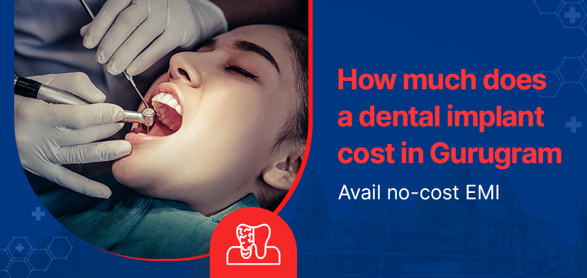 dental implant cost in Gurugram