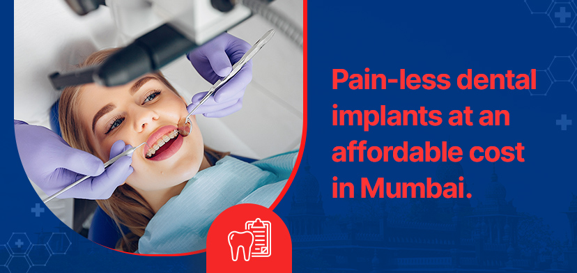 Pain-less dental implants at an affordable cost in Mumbai.