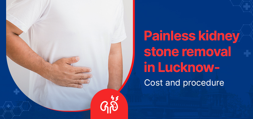 Painless kidney stone removal in Lucknow