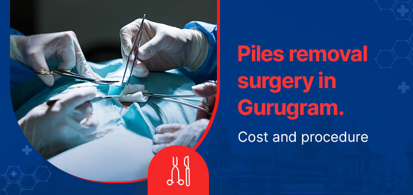 Piles removal surgery in Gurugram – Cost and procedure