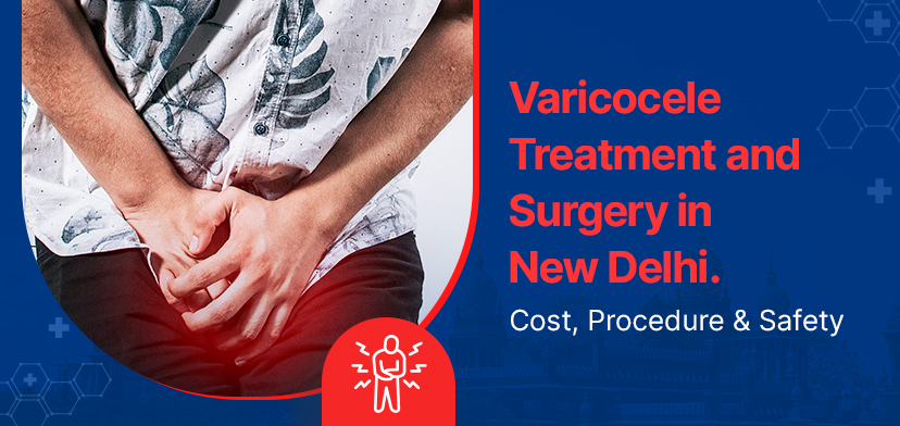 Varicocele Treatment and Surgery in New Delhi