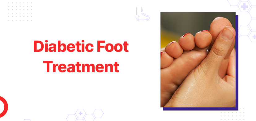 Diabetic Foot Treatment – Symptoms, Cost, and Care