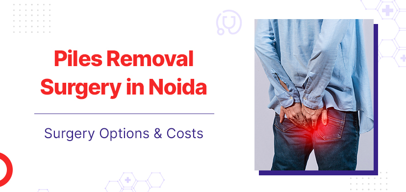 Piles Removal Surgery In Noida – Surgery Options & Costs