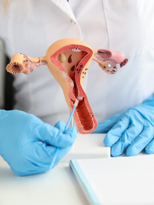 Various Types of Infertility