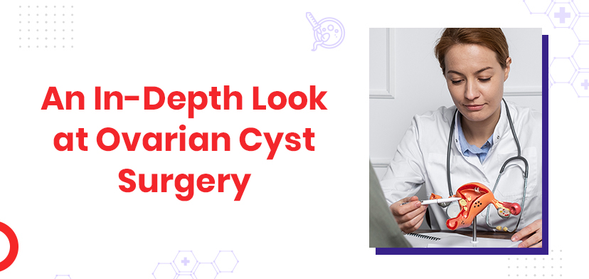 An-Overview-of-Ovarian-Cyst-Surgery