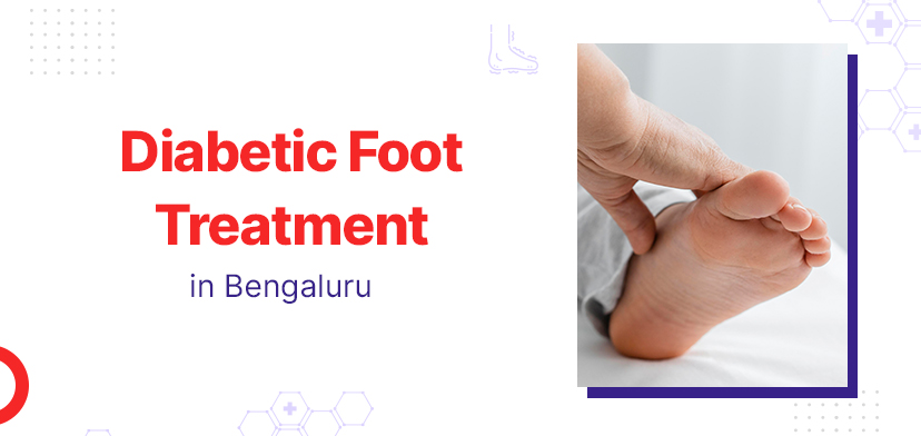 Diabetic Foot Treatment- What to Expect in Bengaluru