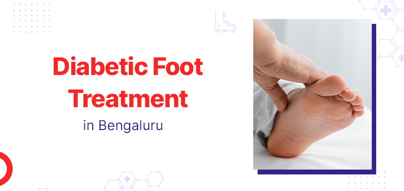 Diabetic Foot Treatment: What to Expect in Bengaluru