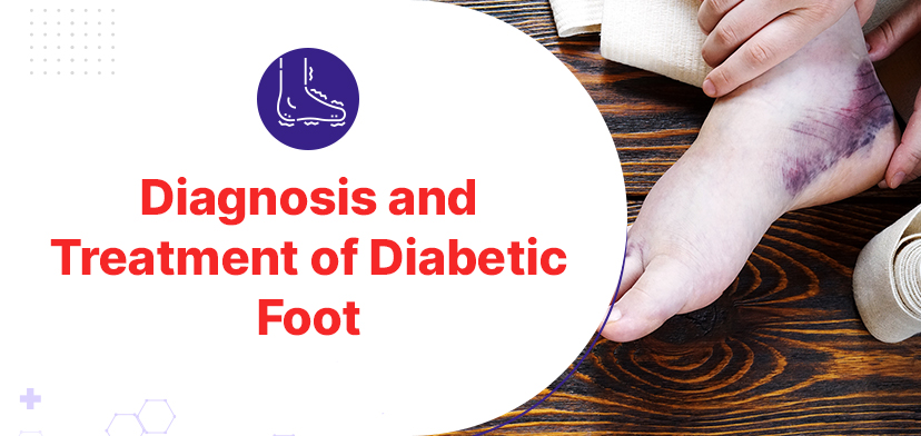 Diagnosis and Treatment of Diabetic Foot in Chennai