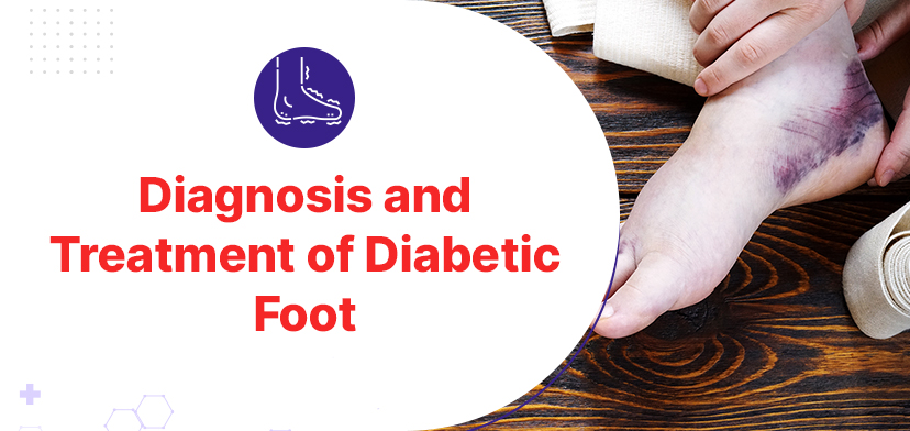 Diagnosis and Treatment of Diabetic Foot in Chennai - Gmoney.in