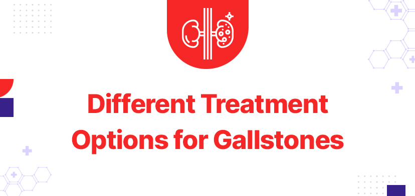 Understanding the Different Treatment Options for Gallstones