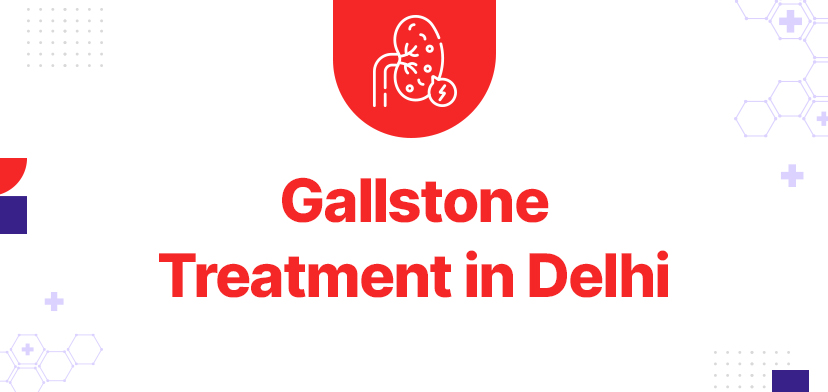 Gallstones Making an Informed Decision About Treatment in Delhi