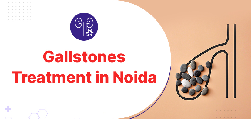 Gallstones Treatment in Noida