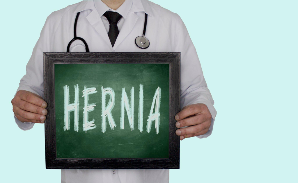 Hernia surgery