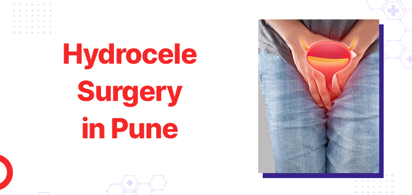 Hydrocele Surgery in Pune: What You Need to Know About This Common Condition