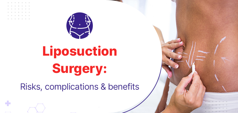 Liposuction Surgery: Risks, Complications And Benefits 