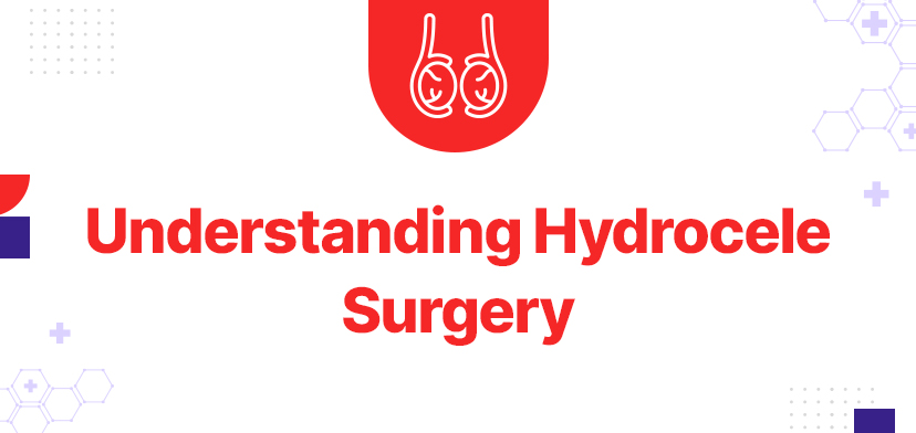 Understanding Hydrocele Surgery