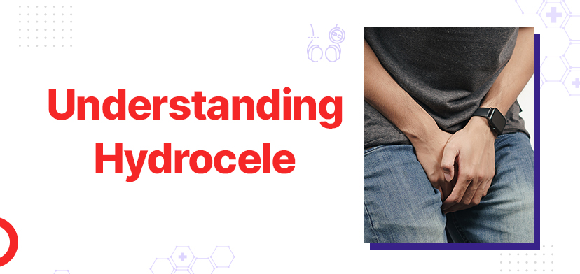 Understanding Hydrocele