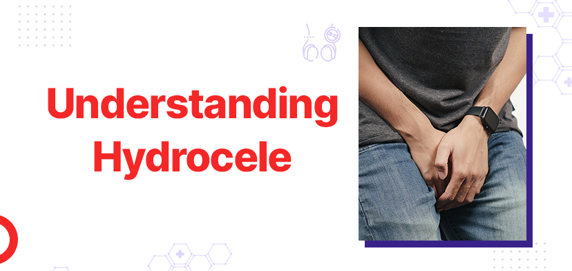 Understanding Hydrocele: Causes, Symptoms, and Treatment Options in Delhi