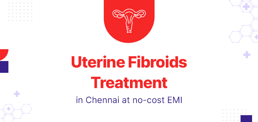 Uterine Fibroids Treatment in Chennai- Understanding the Costs and Risks