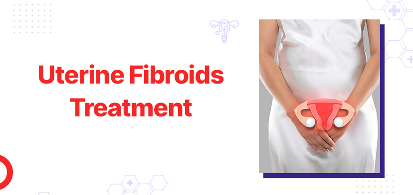 Uterine Fibroids Treatment in Indore: All You Need to Know