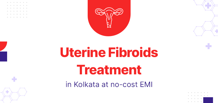 Uterine Fibroids Treatment in Kolkata: Understanding the Costs and Risks