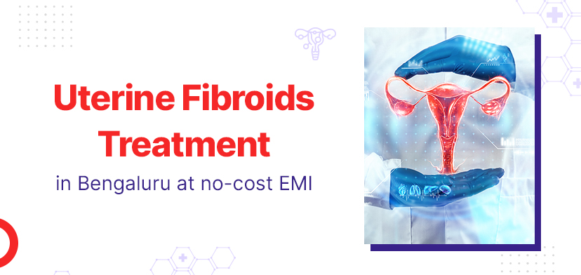 Uterine Fibroids: Understanding the Cost of Treatment in Bengaluru