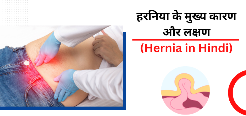 рд╣рд░рдирд┐рдпрд╛ рдХреЗ рдореБрдЦреНрдп рдХрд╛рд░рдг рдФрд░ рд▓рдХреНрд╖рдг (Hernia in hindi)