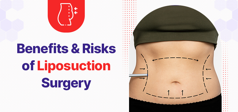Benefits and Risks of Liposuction Surgery