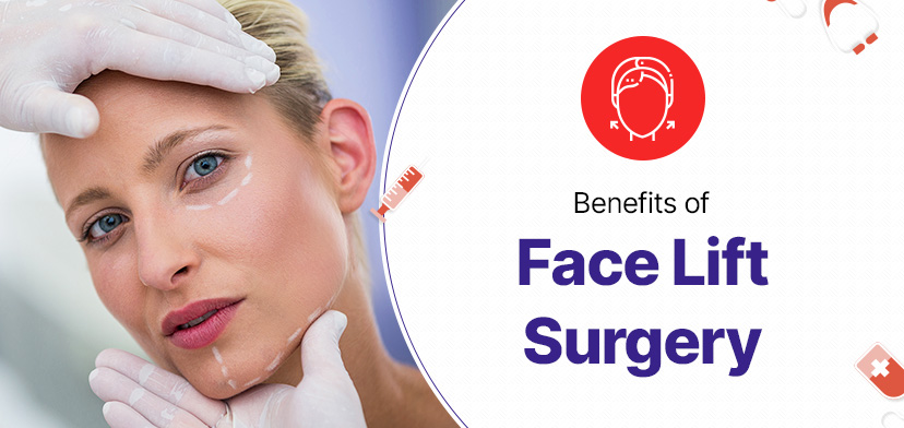 Benefits of Face Lift Surgery