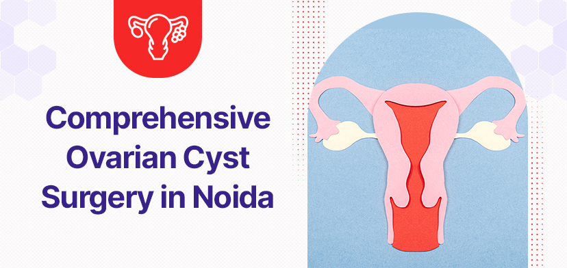 Comprehensive Ovarian Cyst Surgery in Noida: Affordable and Reliable