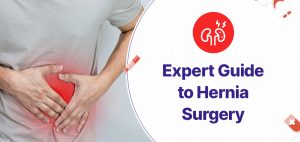 Expert Guide to Hernia Surgery in Mumbai- Everything You Need to Know