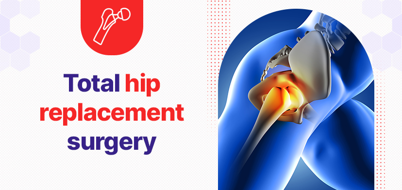 Hip replacement surgery cost in Chennai Get no-cost EMI with GMoney