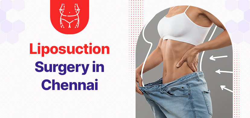 Liposuction Surgery in Chennai