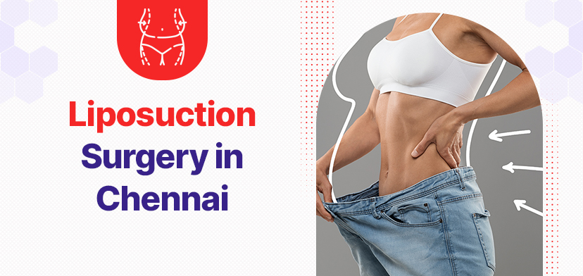 Liposuction Surgery Cost In Chennai: What You Need To Know