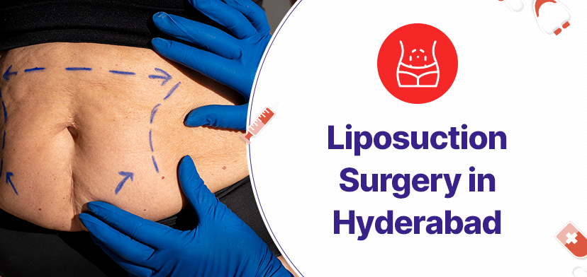 Liposuction Surgery in Hyderabad
