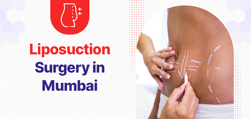 Liposuction Surgery In Mumbai: Safe, Effective, and Life-Changing