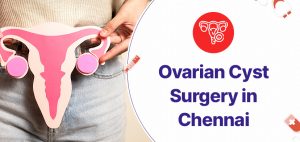 Ovarian Cyst Surgery in Chennai- Purpose, procedure, risks and recovery