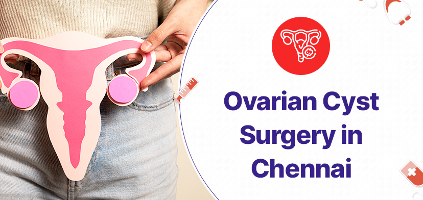 Ovarian Cyst Surgery in Chennai: Purpose, procedure, risks and recovery