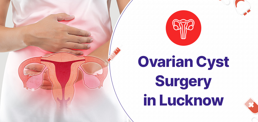 Ovarian Cyst Surgery in Lucknow- Cost, what to expect, tips & advice