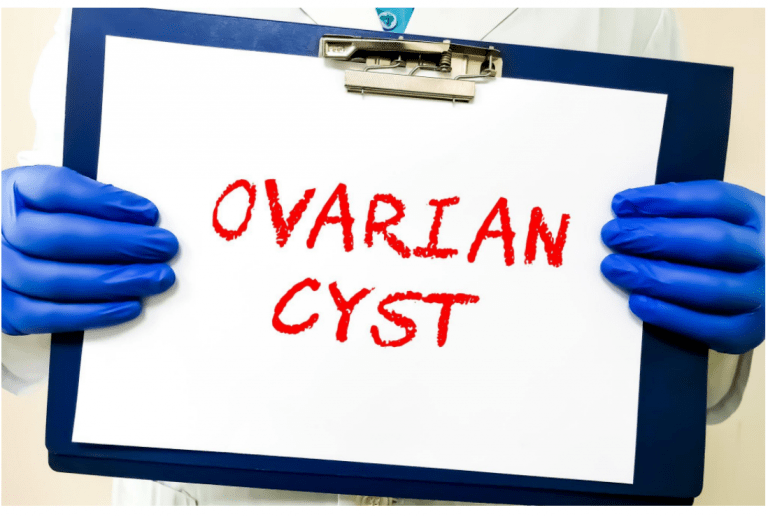 Your Guide to Safe and Effective Ovarian Cyst Surgery in Mumbai Gmoney.in