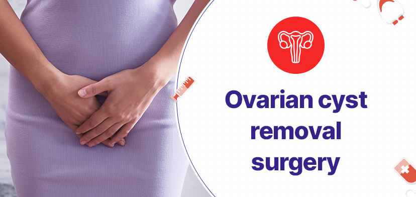 Ovarian cyst removal surgery in Hyderabad- What to expect