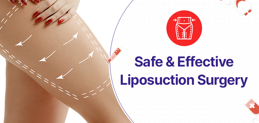 Safe And Effective Liposuction Surgery In Kolkata