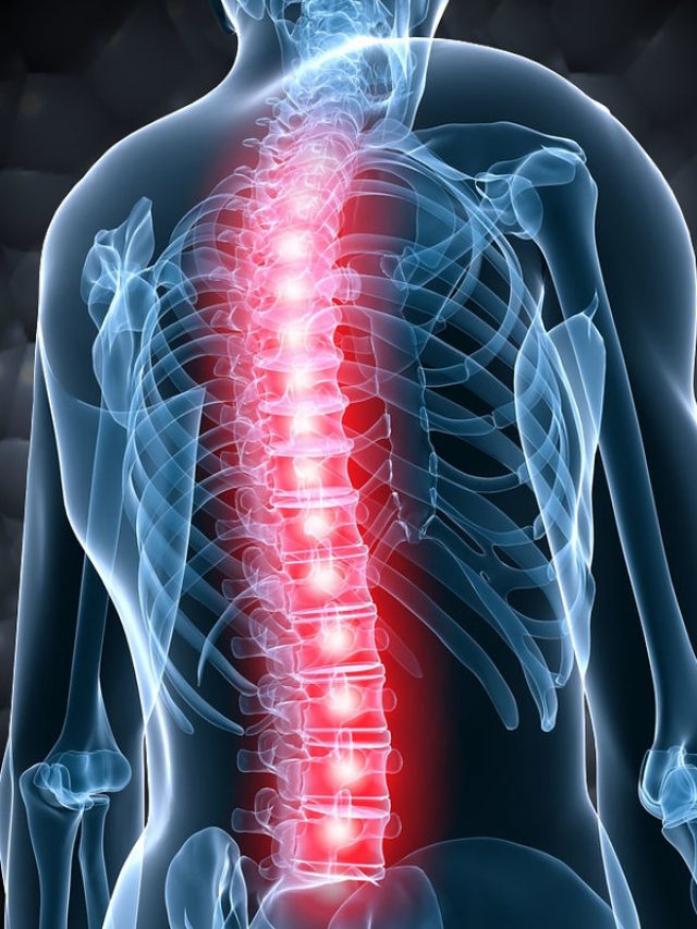 कमर दर्द के करण [ kamar dard ke karan ]