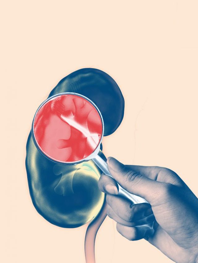 किडनी खराब होने के लक्षण [kidney kharab hone ke lakshan]