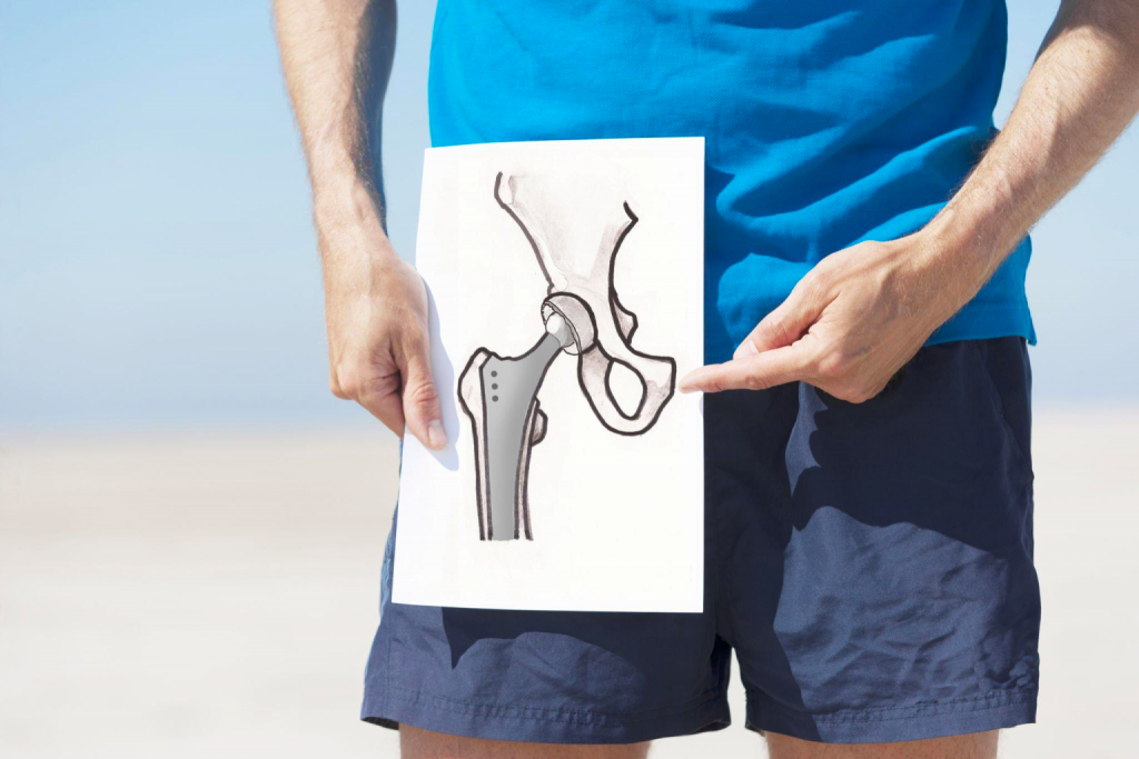 hip replacement surgery 2