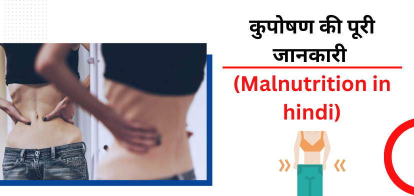 कुपोषण के उपचार, कारण और लक्षण (MALNUTRITION IN HINDI )