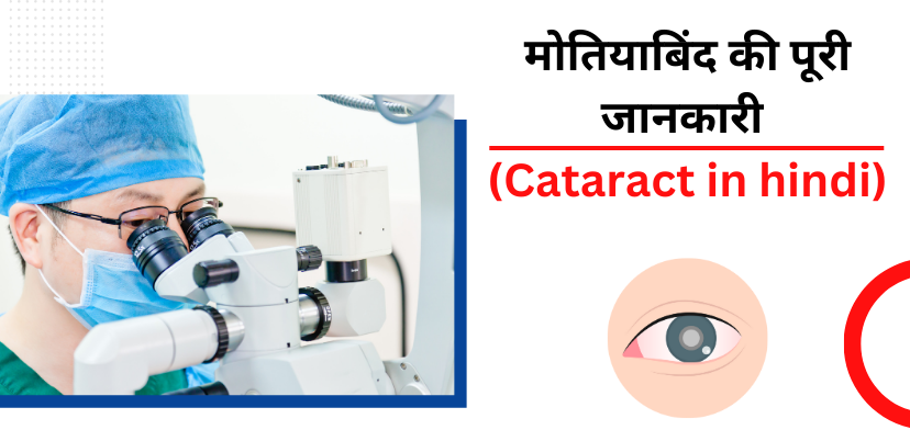 cataract in hindi